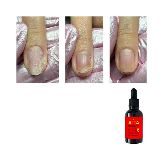 ALTA treatment oil (100% pure natural oil) mit Pipette